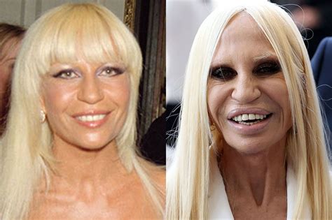 donatella versace schönheits op
